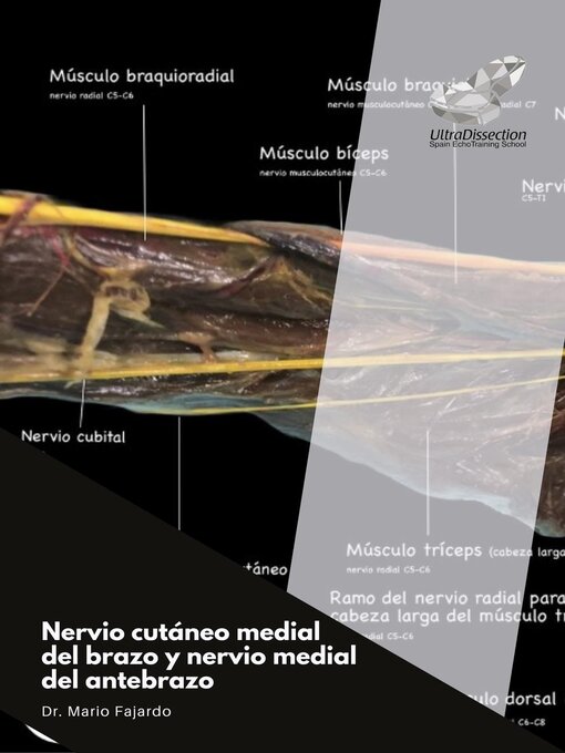 Title details for Nervio cutáneo medial del brazo y nervio medial del antebrazo by Mario Fajardo - Available